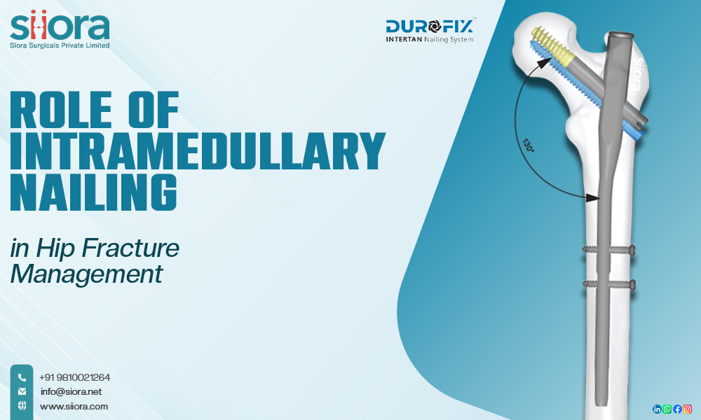 Role of Intramedullary Nailing in Hip Fracture&nbsp;Management