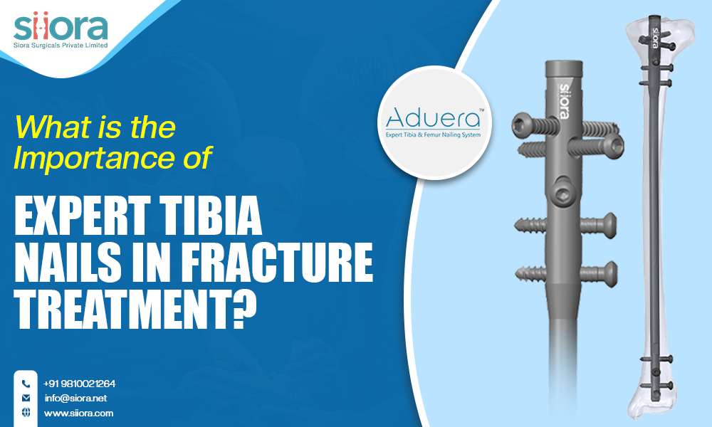 What is the Importance of Expert Tibia Nails in Fracture&nbsp;Treatment?